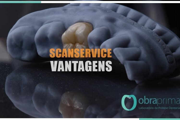 Scanservice Vantagens