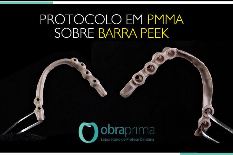 08-priticilo-pmma--barra-peek-